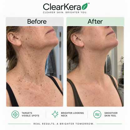 ClearKera Glycolic Body Stick