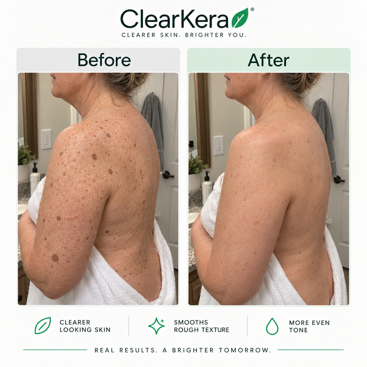 ClearKera Glycolic Body Stick