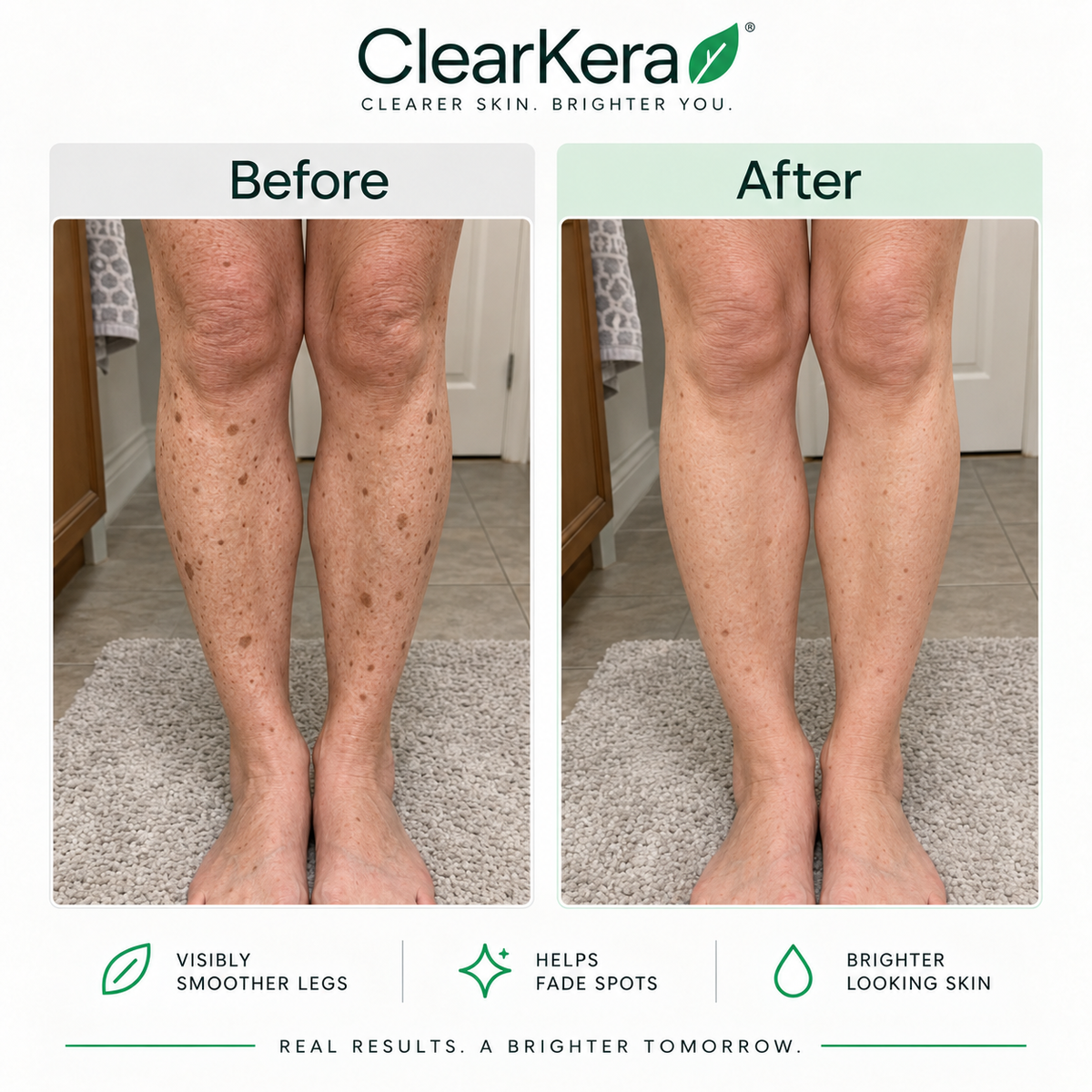 ClearKera Glycolic Body Stick