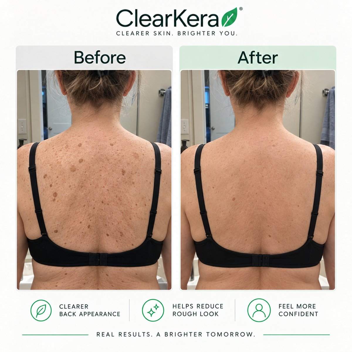 ClearKera Glycolic Body Stick