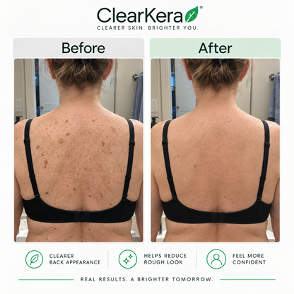 ClearKera Glycolic Body Stick