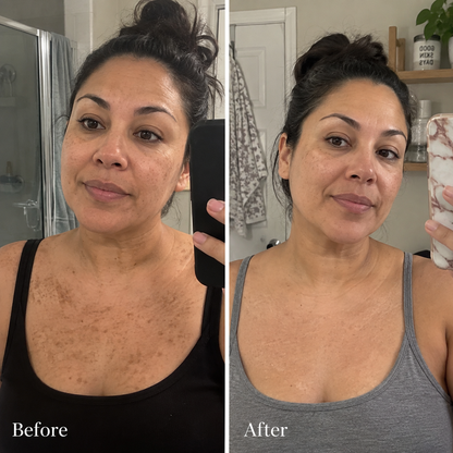 ClearKera Glycolic Body Stick (Copy)