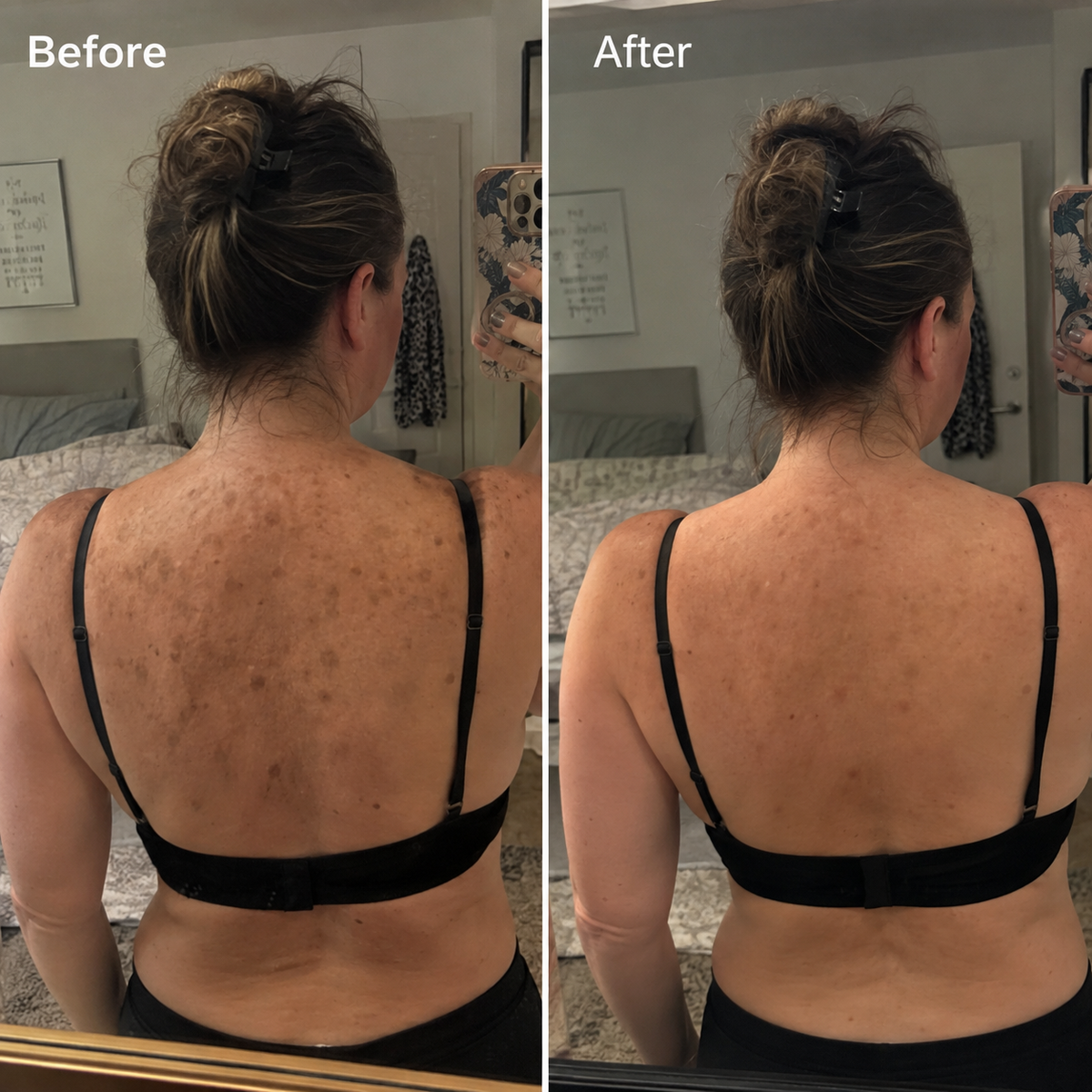 ClearKera Glycolic Body Stick (Copy)