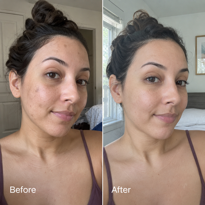 ClearKera Glycolic Body Stick (Copy)